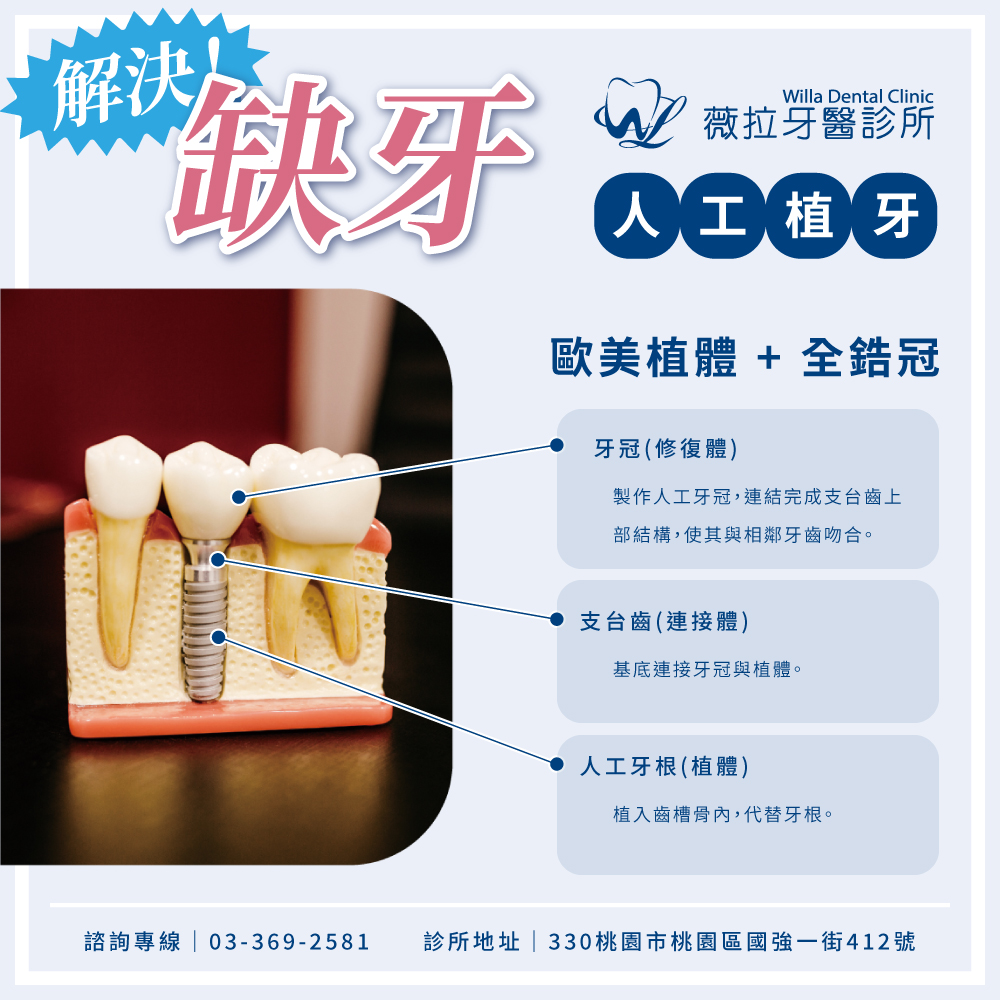前往#植牙 — 是能讓家中缺牙患者重新擁有牙齒的方法內頁